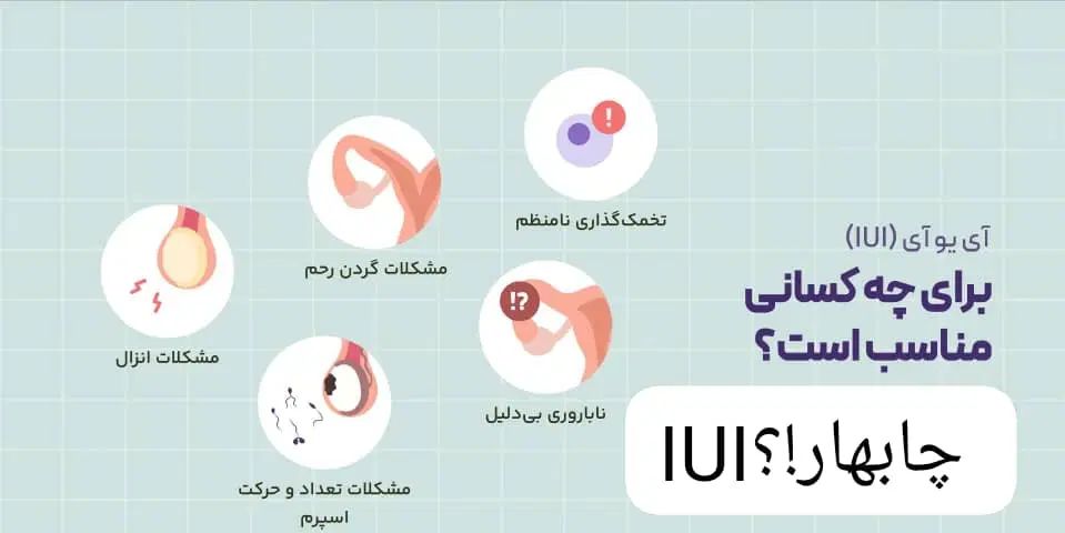 مشاوره درمان ناباروری IUI