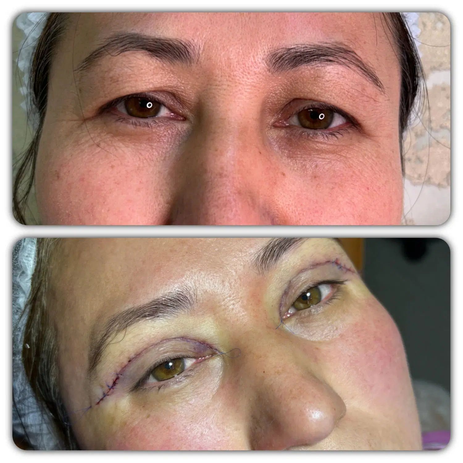 کلینیک تخصصی جراحی پلک و زیبایی چشم