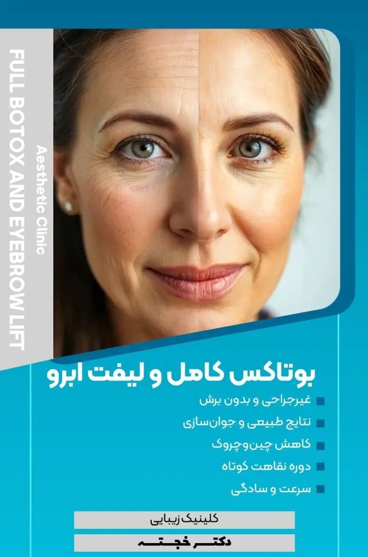 جشنواره بوتاکس مصپورت با قیمت فوق العاده