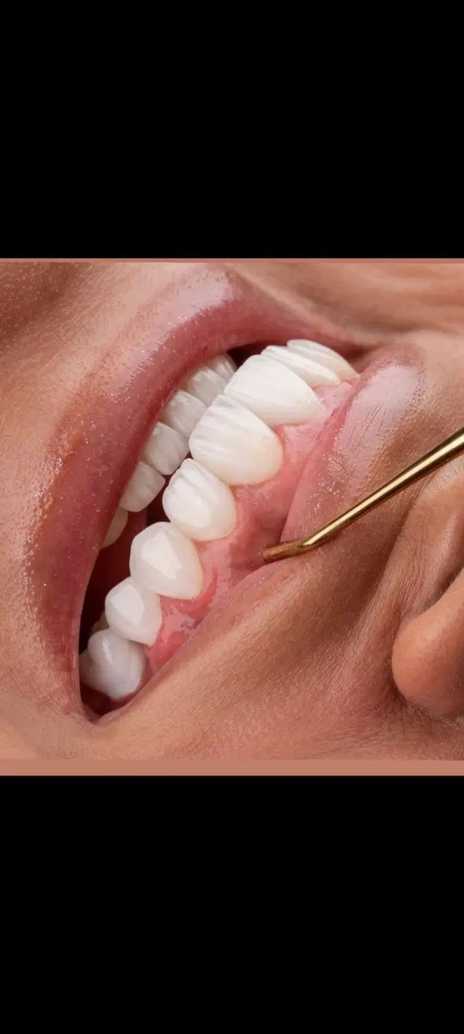 دندانپزشکی اقساط ۴ماهه بدونِ کارمزد