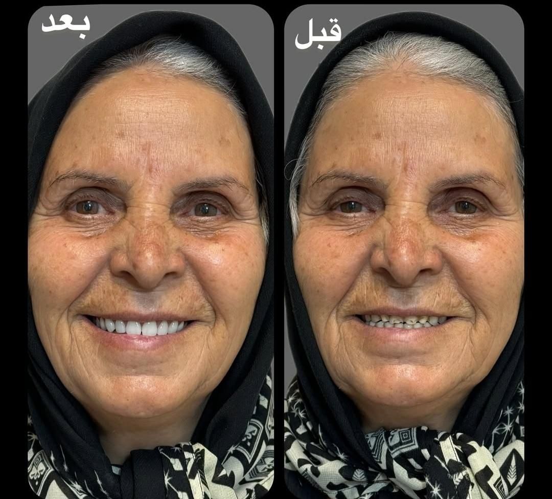 مرکز ساخت تخصصی دندان مصنوعی،دندانسازی باضمانت