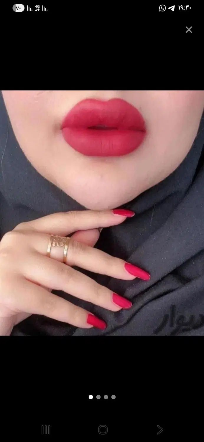 جشنواره تخفیف بوتاکس در قم