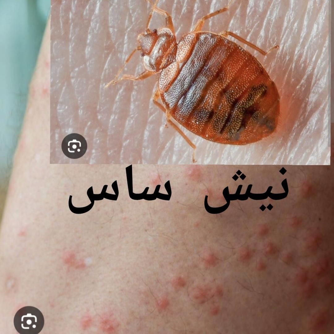 سمپاشی ساس سم پاشی سوسک در تمام نقاط تهران و حومه