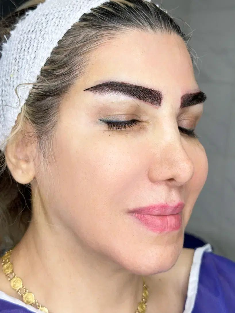 کاشت ابرو طبیعی متد فاین برو نیدل بنفش خواب طبیعی