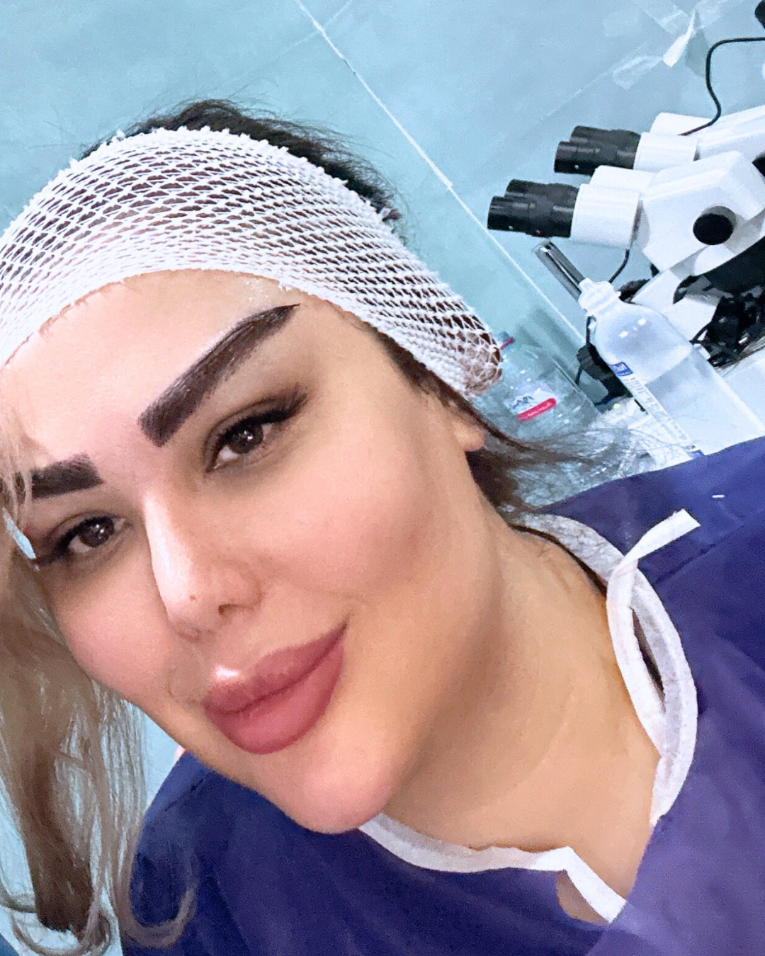 کاشت ابرو متد فاین برو در شیراز
