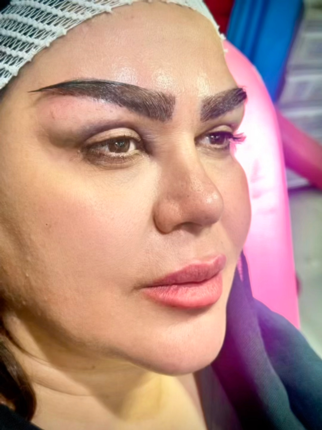 فاین برو کاشت در شیراز