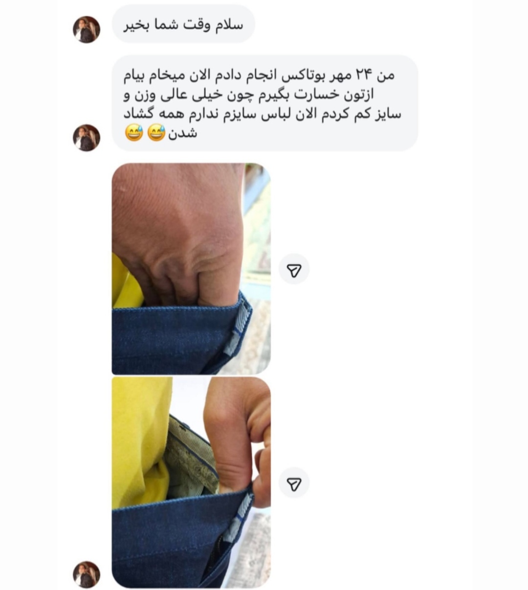با بوتاکس معده کاهش سایز رو تجربه کنین