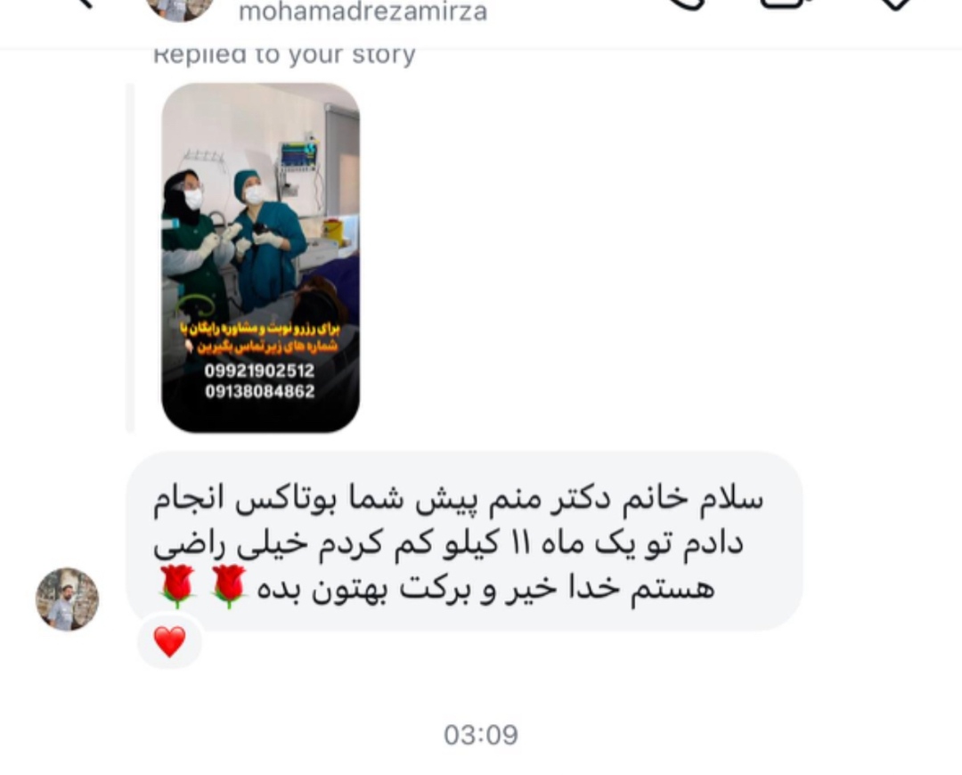 کاهش وزن 11کیلو در یک ماه با بوتاکس معده