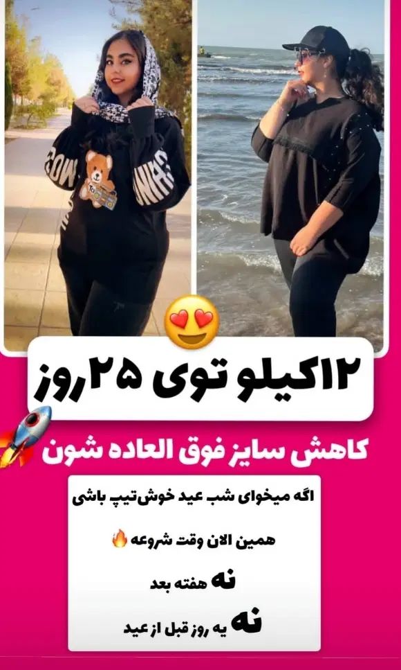 پکیج لاغری با تخفیف ویژه و شرایط اقساط