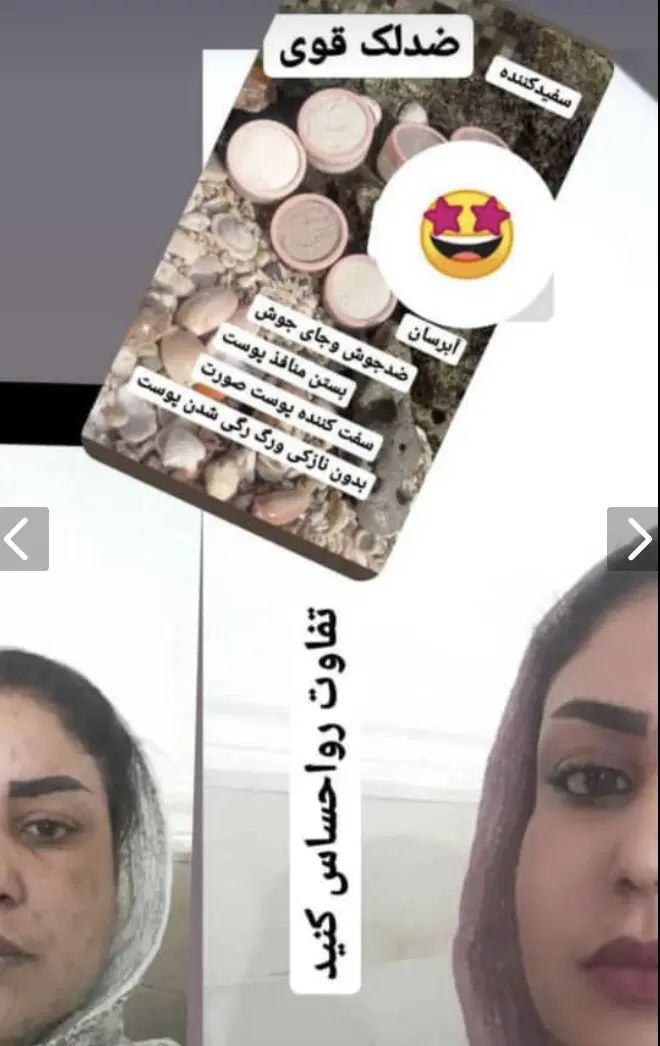 پاکسازی پوست دایمی ضدلک سفیدکننده تضمینی