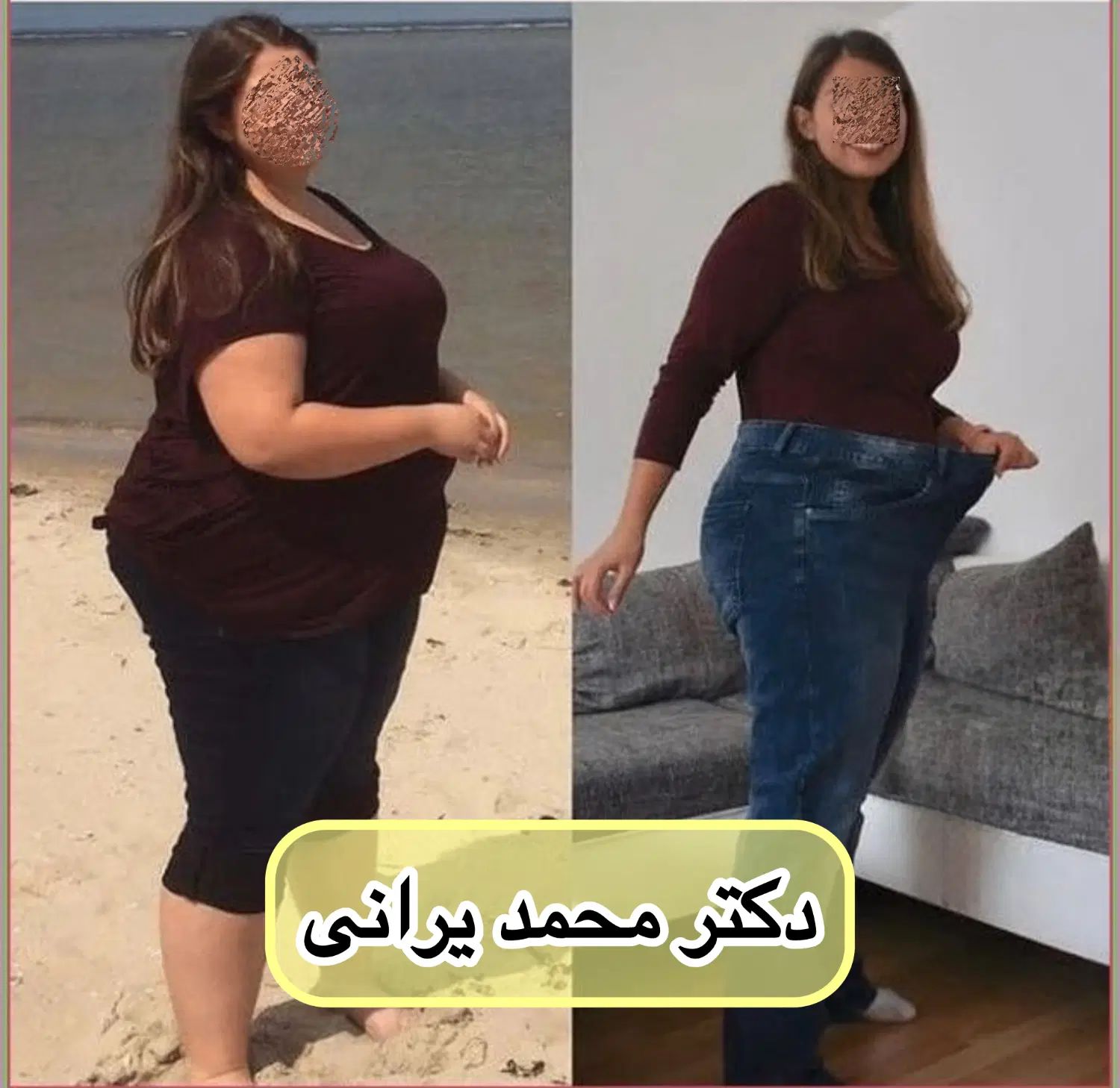 بهترین دکتر لاغری اسلیو معده تهران