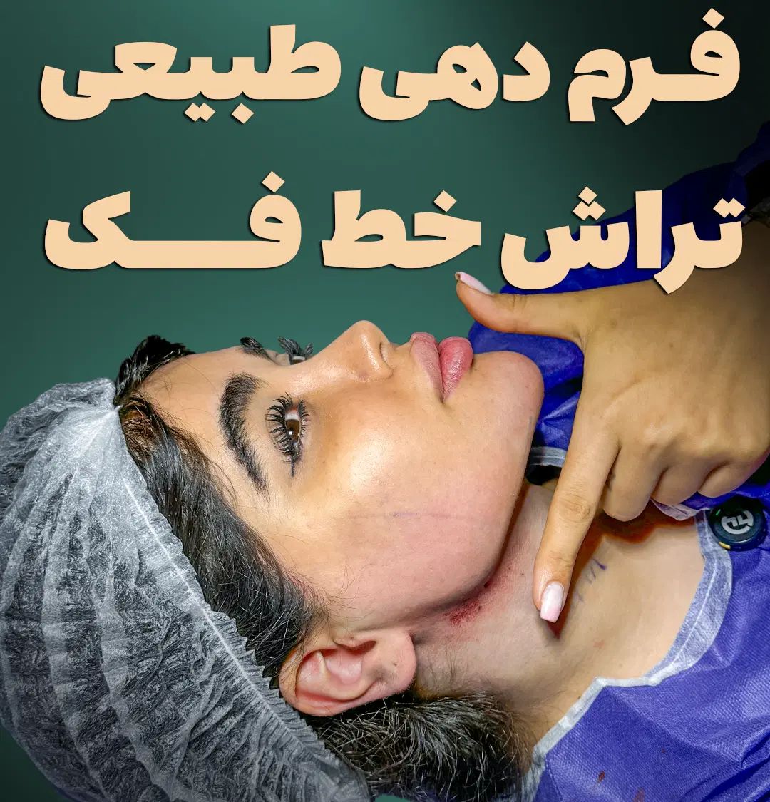 ساکشن غبغب ، بلفاروپلاستی