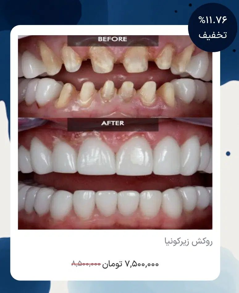 خدمات کامل دندانپزشکی با تعرفه دولتی
