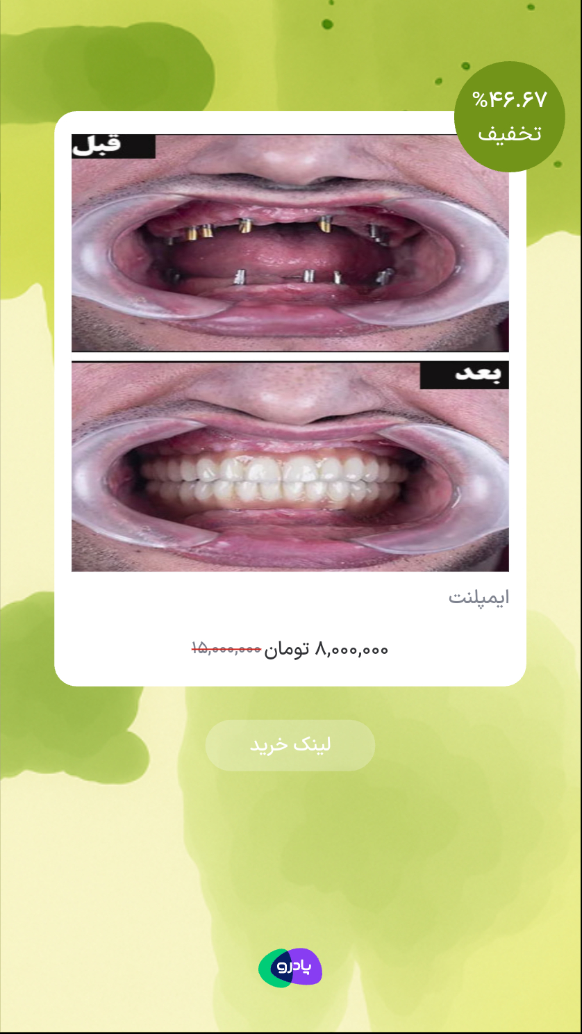 ایمپلنت