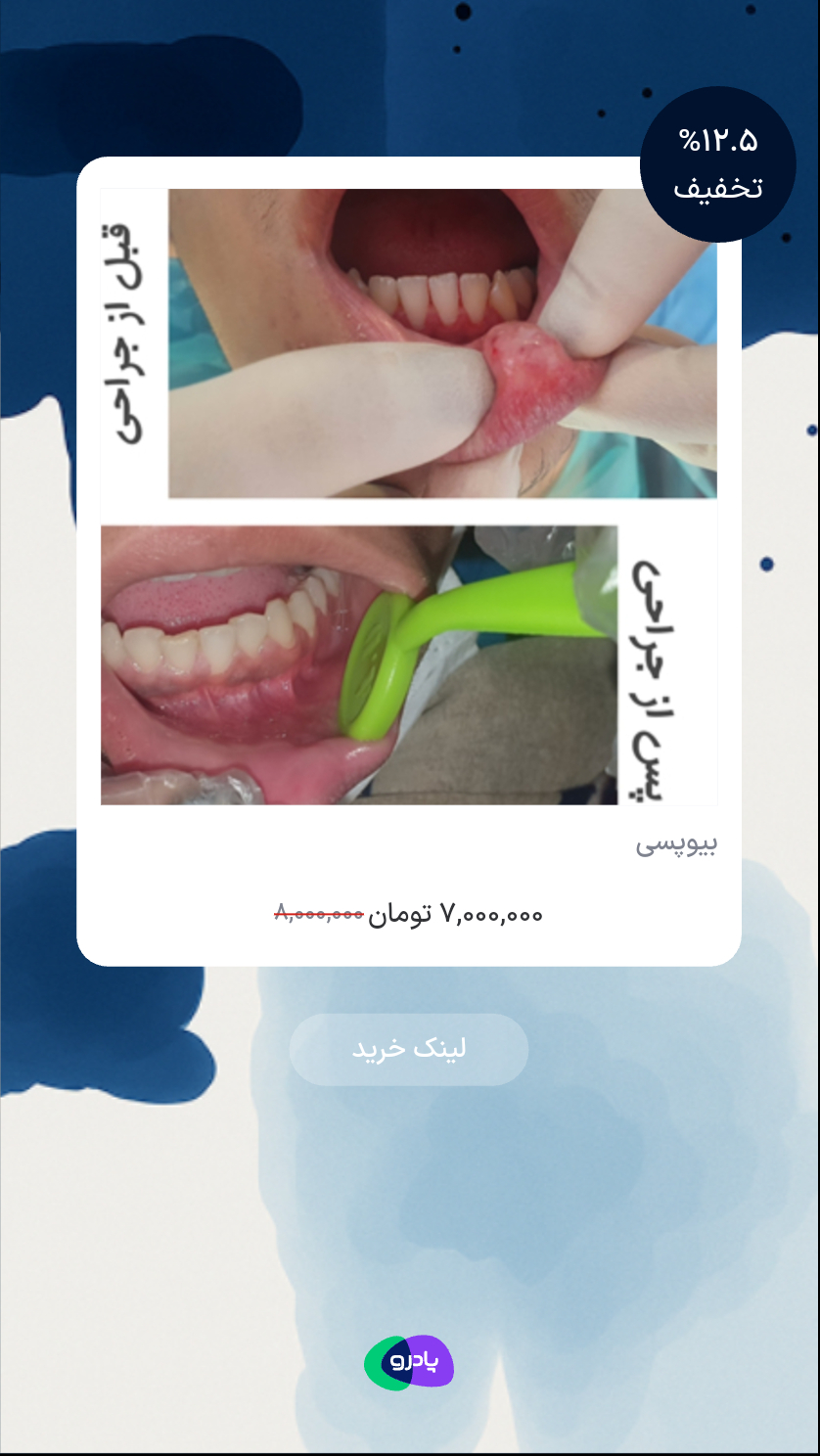 بیوپسی
