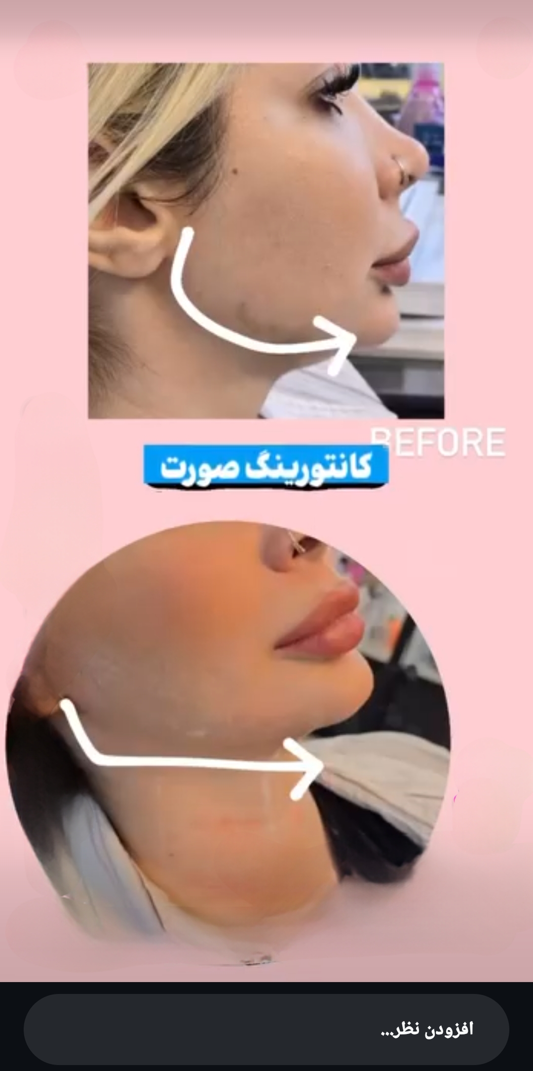 کانتورینگ صورت
