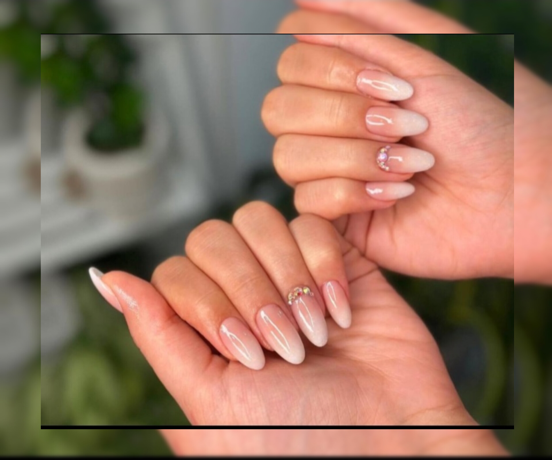 آمبره کاشت ژل