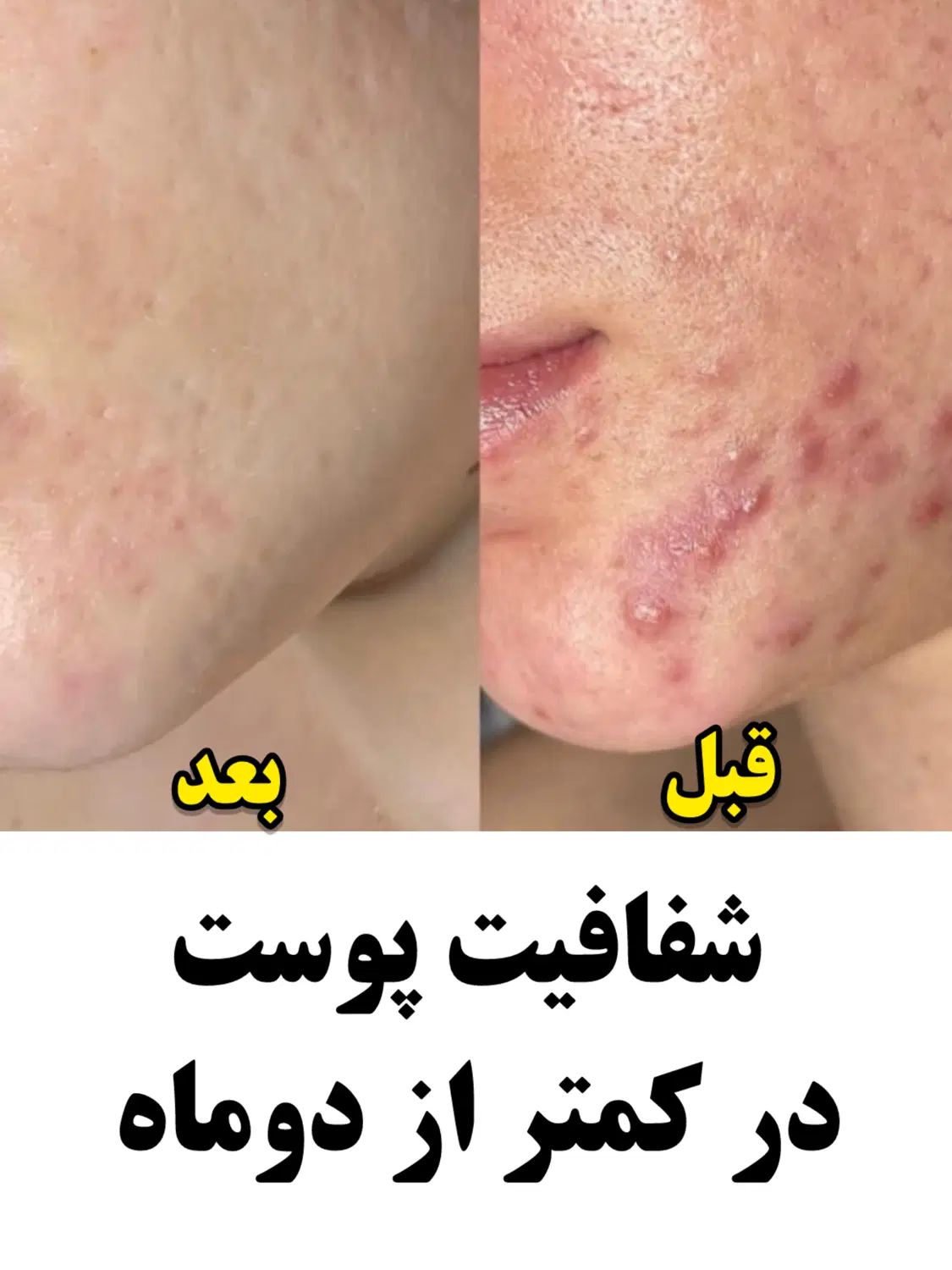 بهبود کبدچرب و معده از نمایندگی