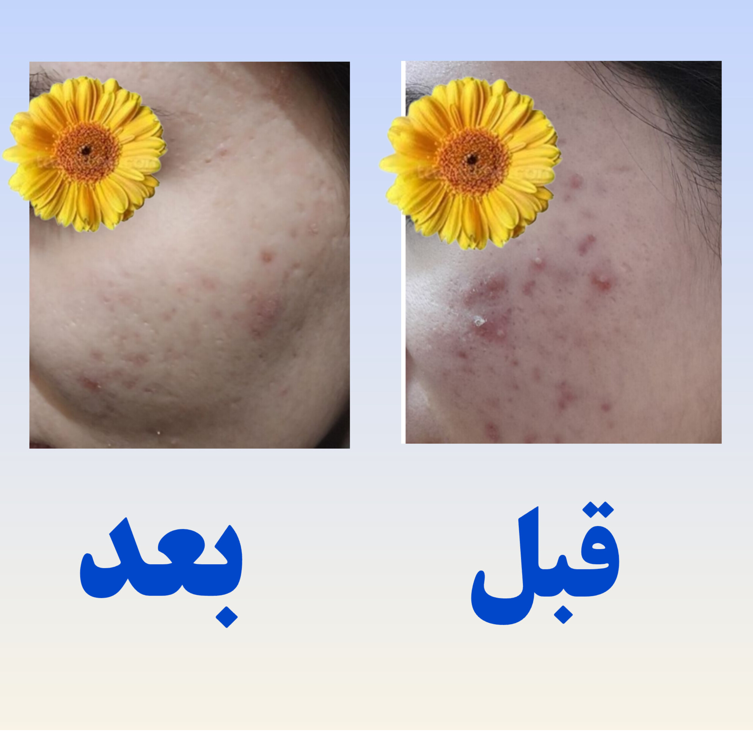 پوست و مو