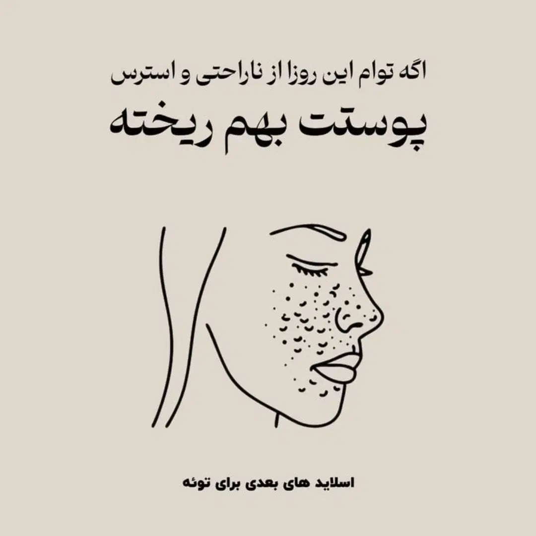 درمان جوش های صورت