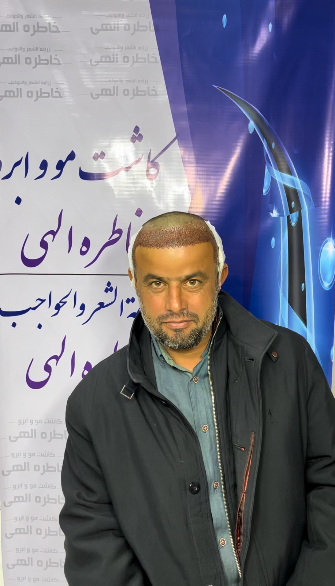 کاشت