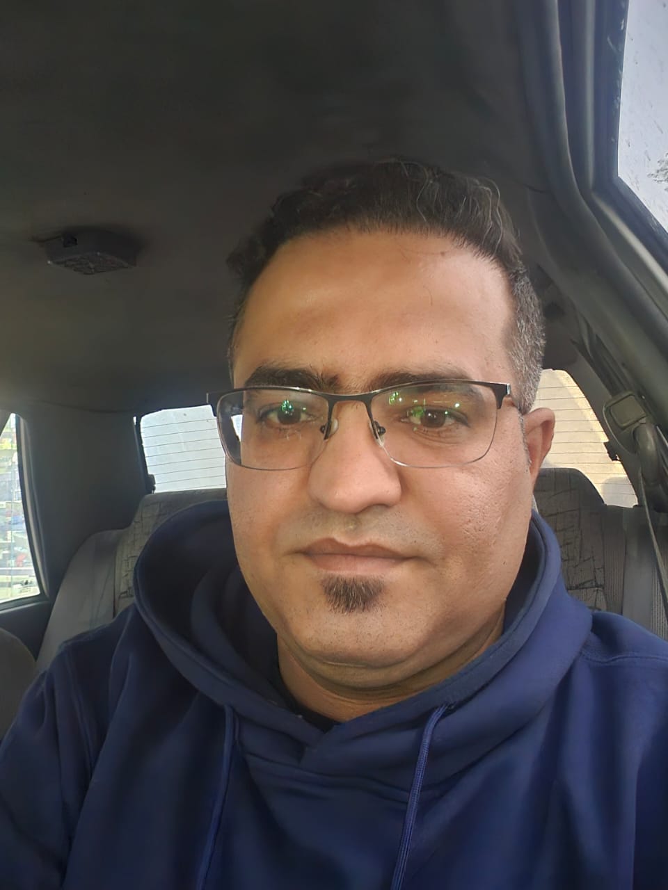کاشت مو