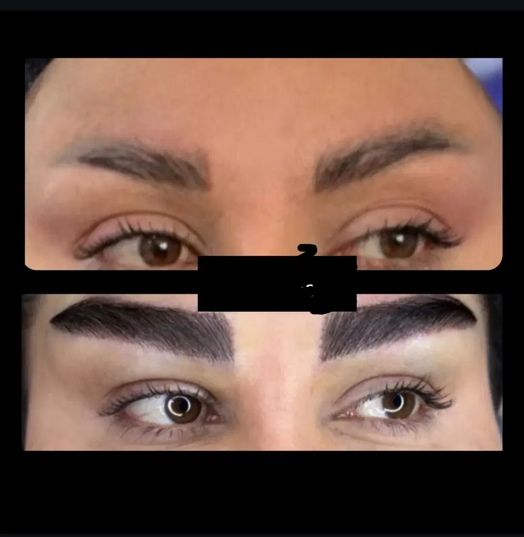 کاشت تخصصی ابرو