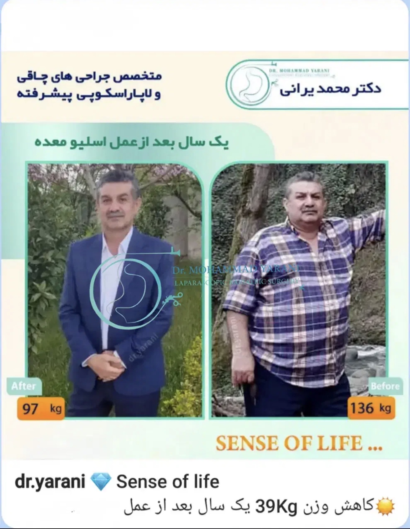 لاغری اسلیو معده با دکتر یرانی جراح با تجربه