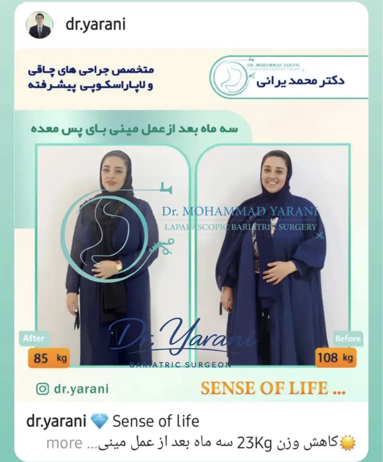 لاغری اسلیو معده با دکتر یرانی جراح با تجربه