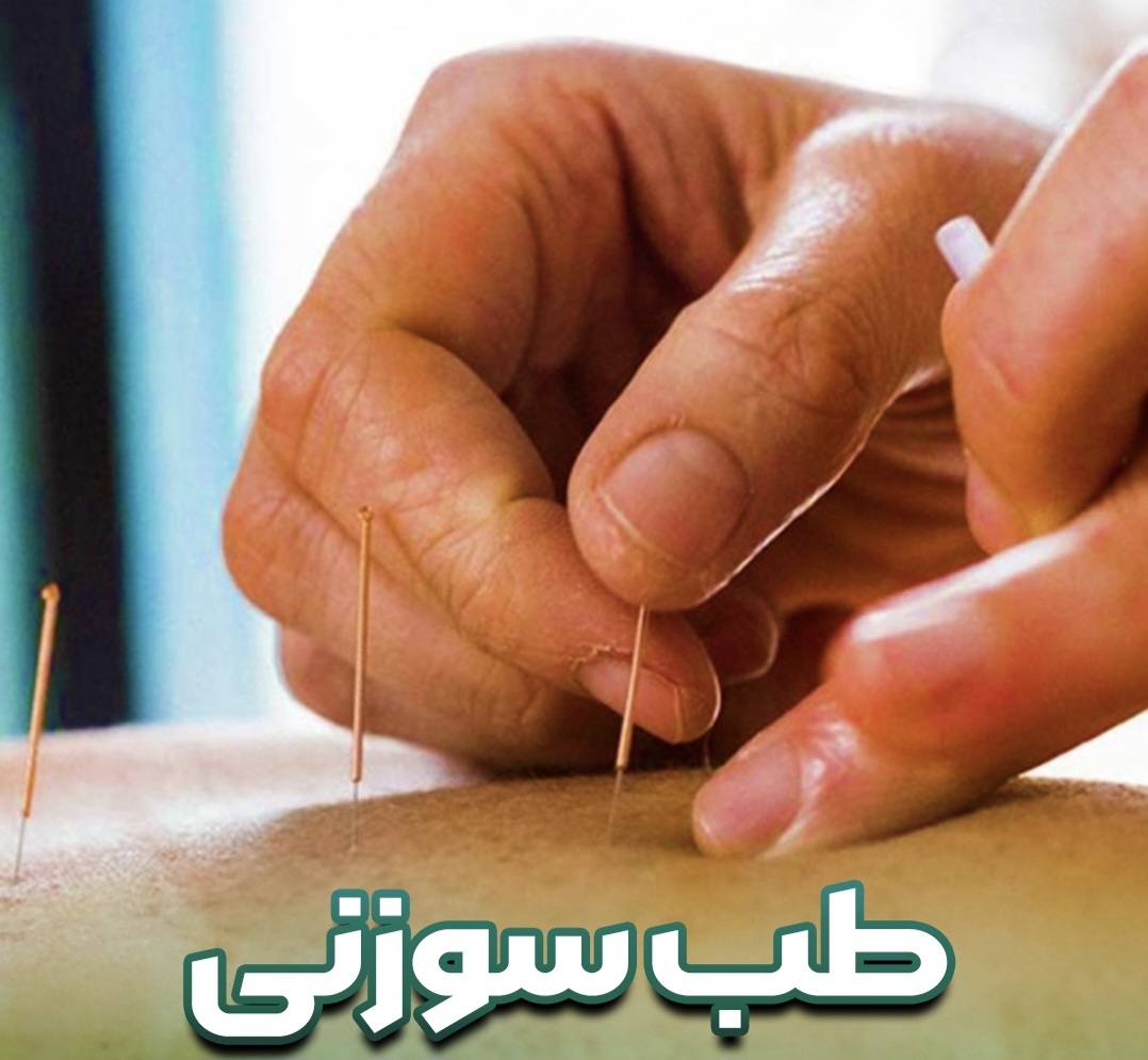طب سوزنی توسط پزشک متخصص