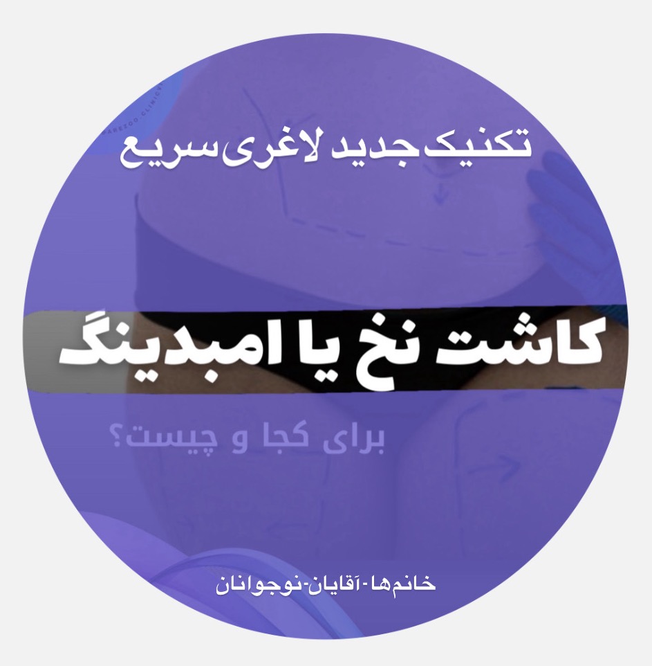 میانبر لاغری امبدینگ »» کاشت نخ