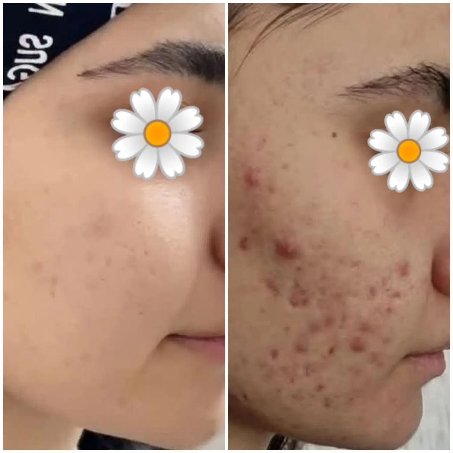 ضدجوش و ضدلک بیومیمتیک