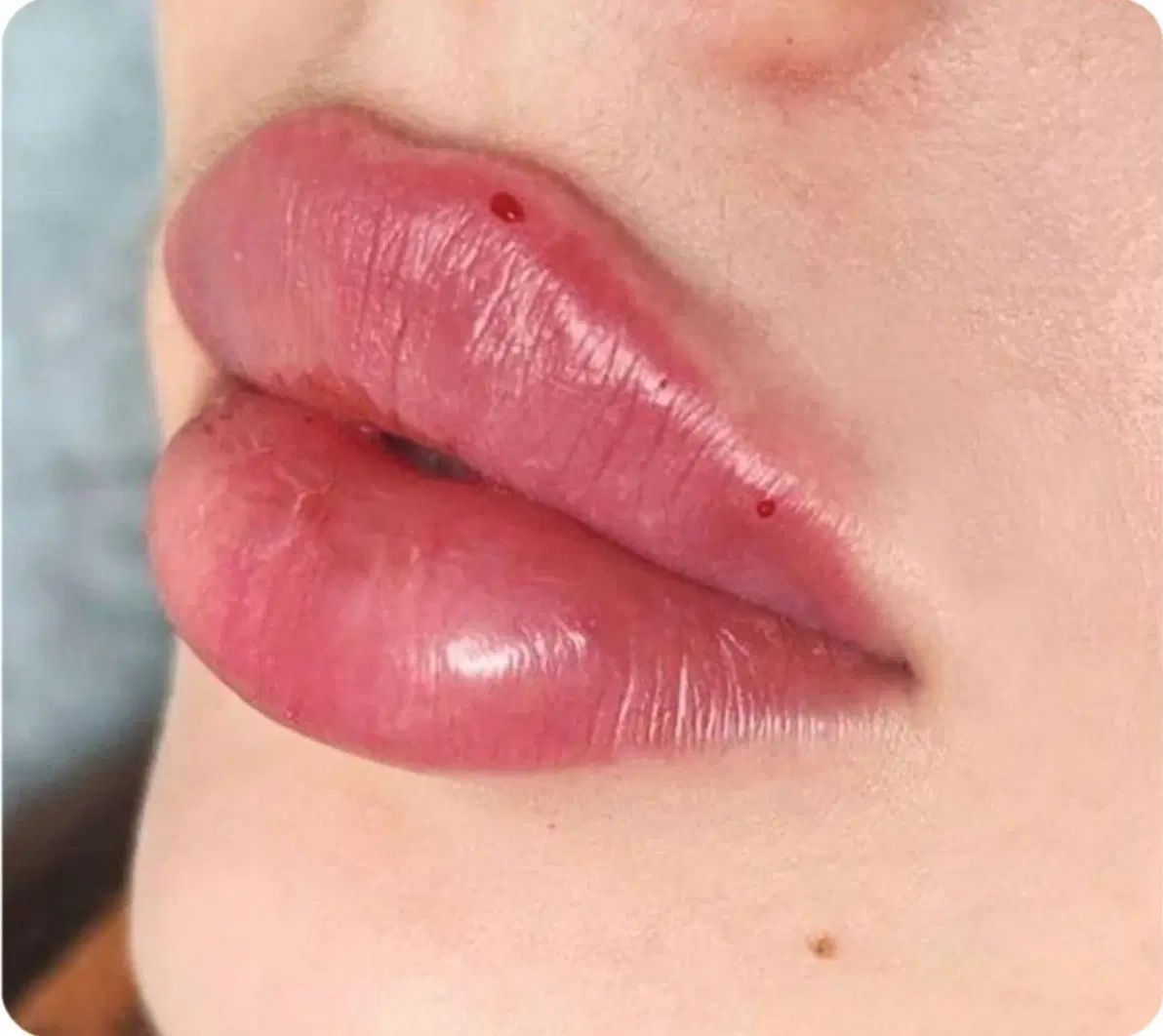 لب روسی،کانتورینگ چهره،فیلربادی،بوتاکس چشم گربه ای