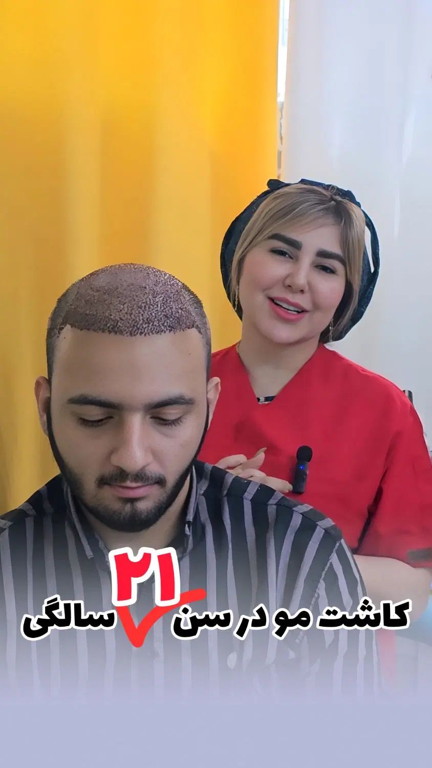کاشت مو ابرو ریش* شیرزادگان *اهواز در اهواز