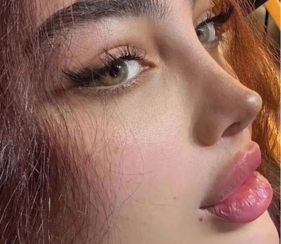 عمل جراحی زیبایی