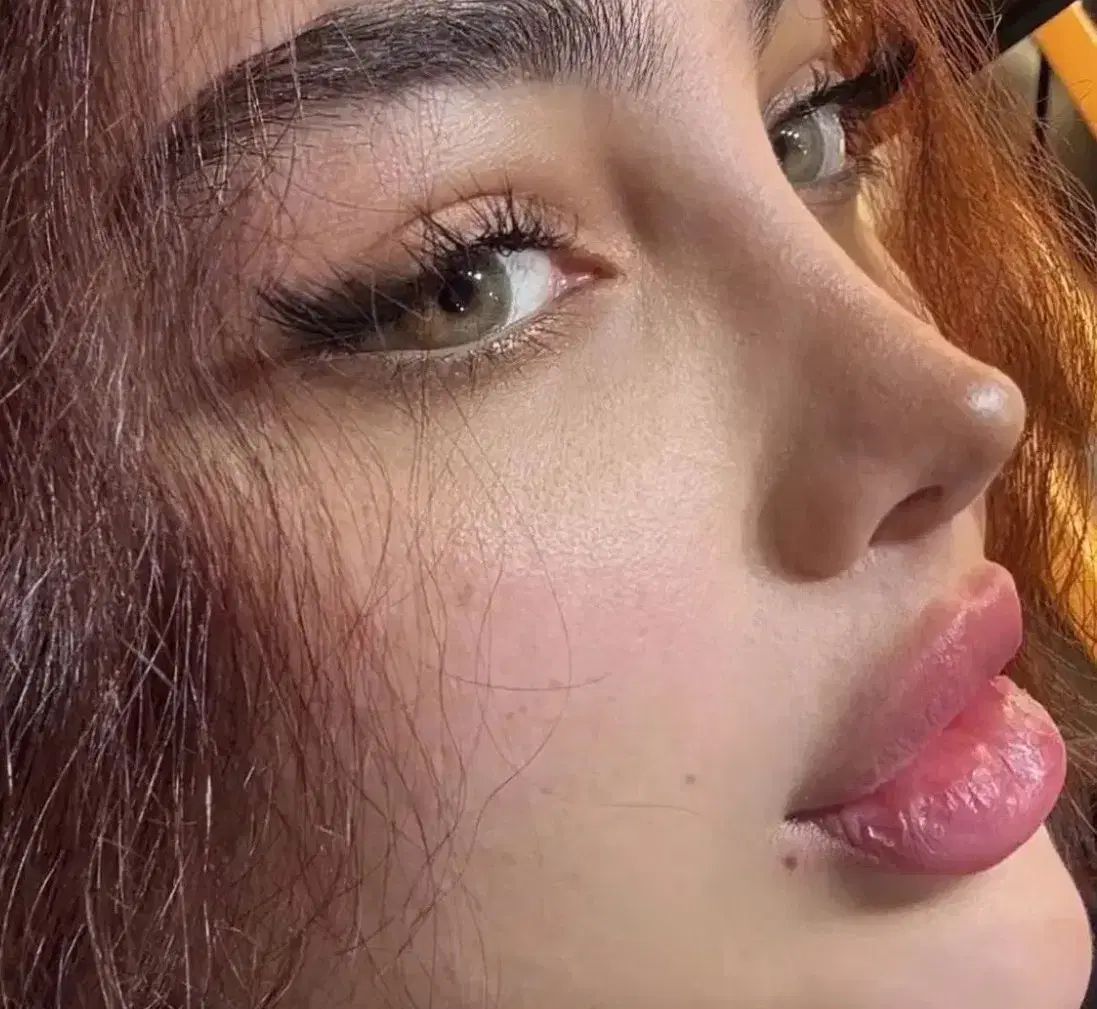 عمل جراحی بینی فقط با ۴۵ تومن