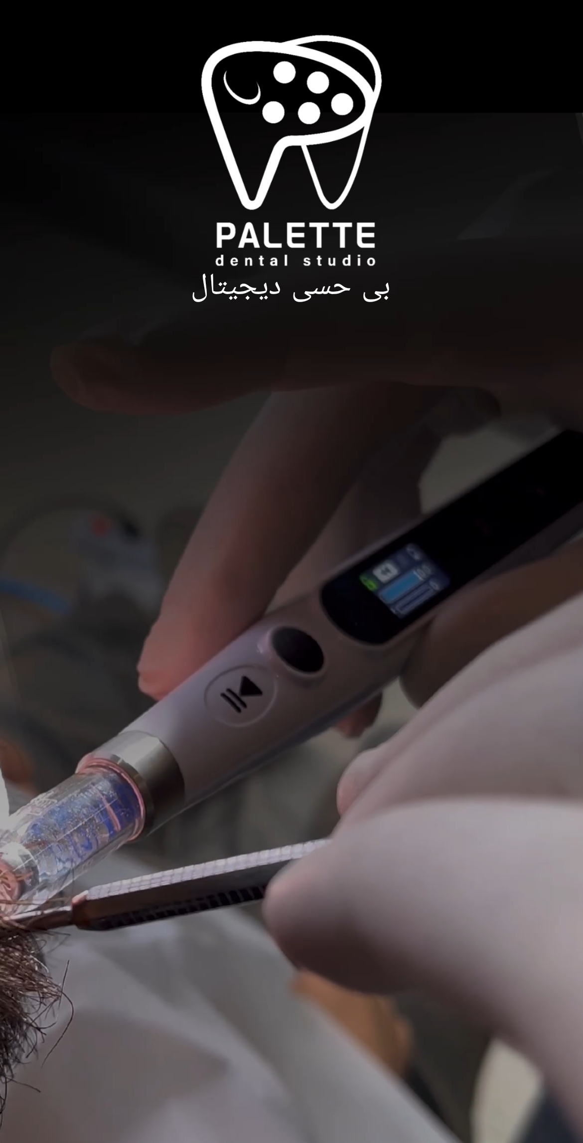 بی حسی دیجیتال