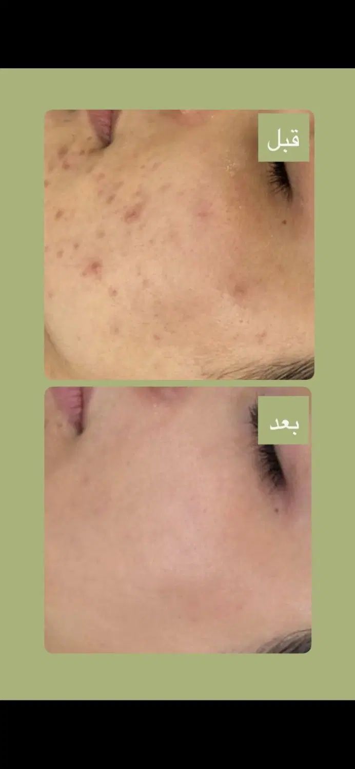 فیشال تخصصی با برند تالاک فرانسه