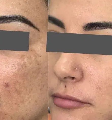 پک کرم و صابون ضدلک و روشن کننده صورت اصل