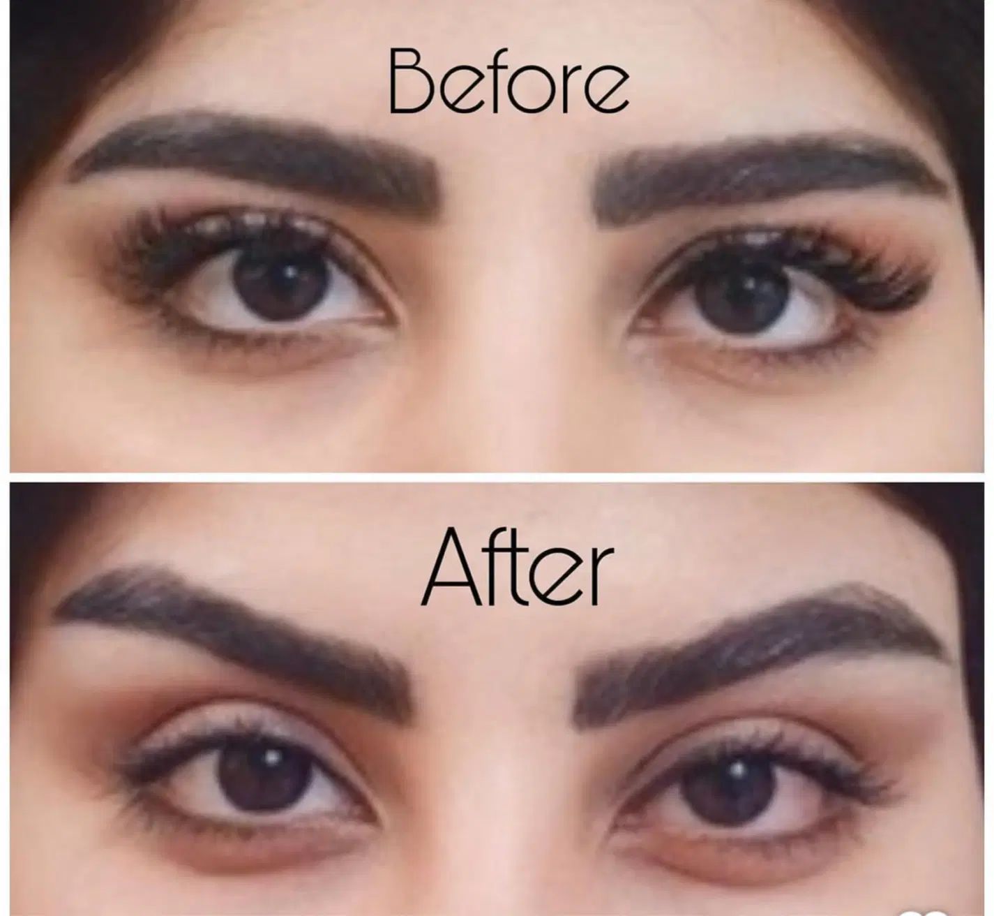 بلفارو،دایرکت ابرو،میدفیس،ساکشن اقساطی