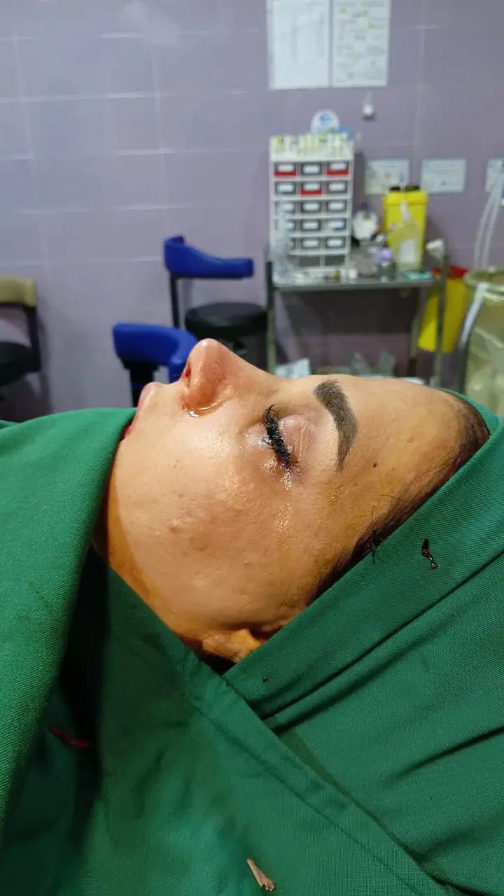 بینی