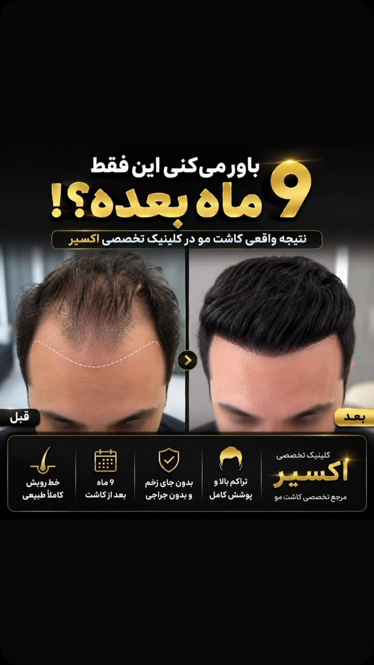 اگر از ریزش مو یا کم‌پشتی خسته شدی، وقتشه برای یک مشاوره تخصصی اقدام کنی.