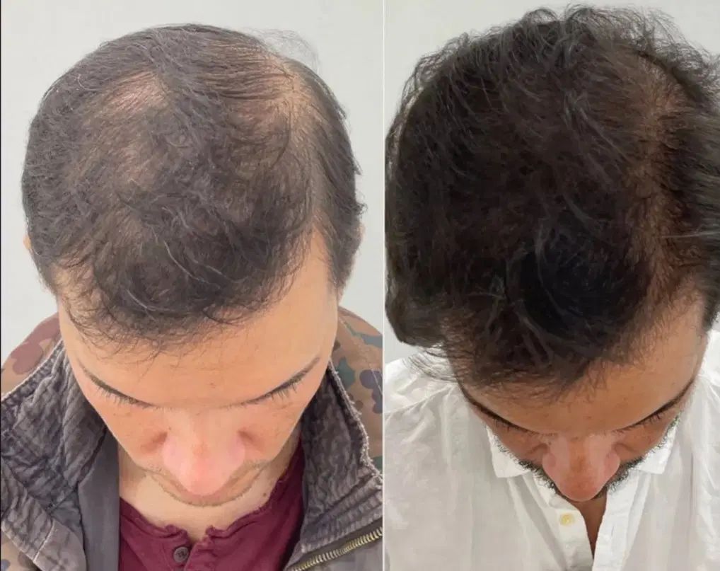نمایندگی رسمی تونیک مو هیر فرند