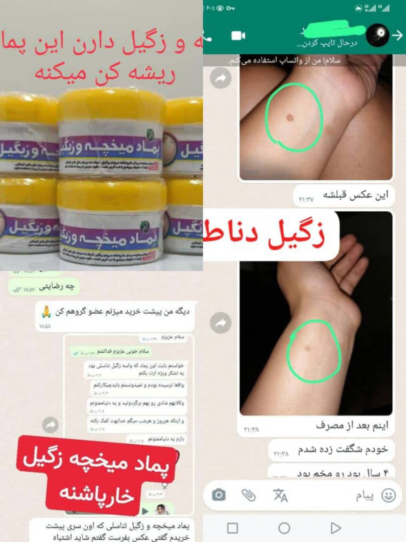 پماد میخچه و زگیل دناطب850