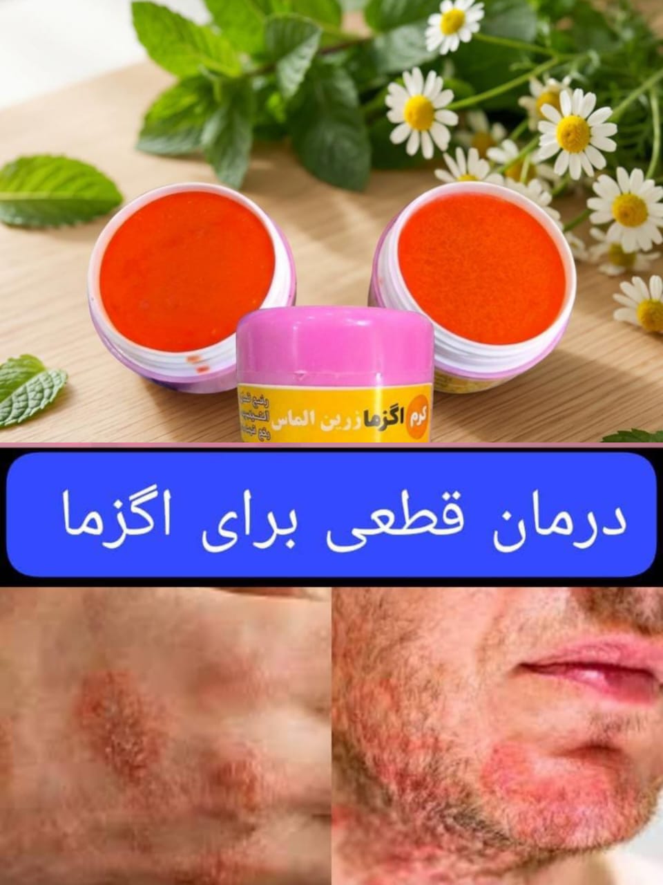 پماد اگزما زرین اصل950