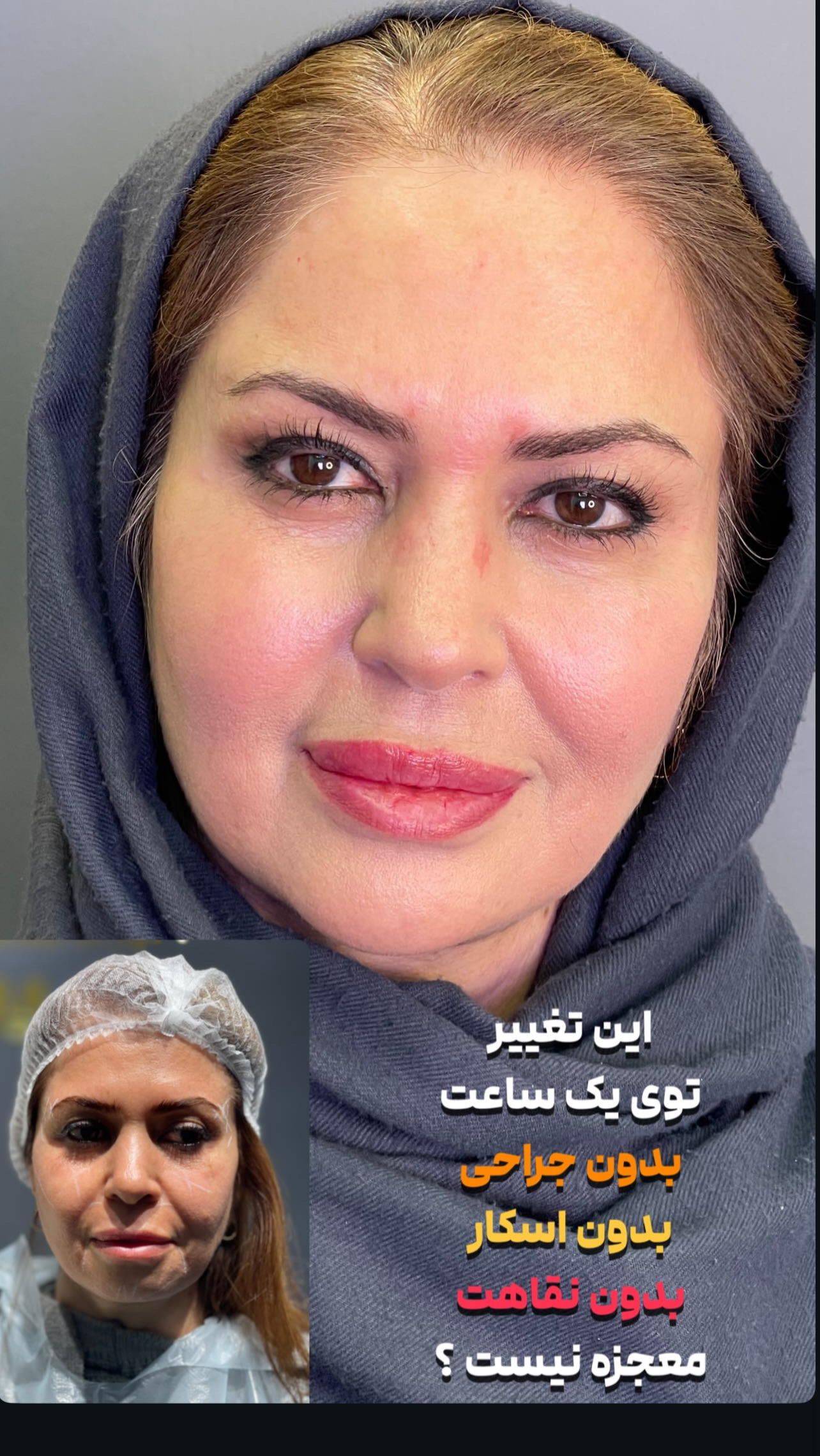 کلینیک زیبایی فیل بیوتی - تصویر 51
