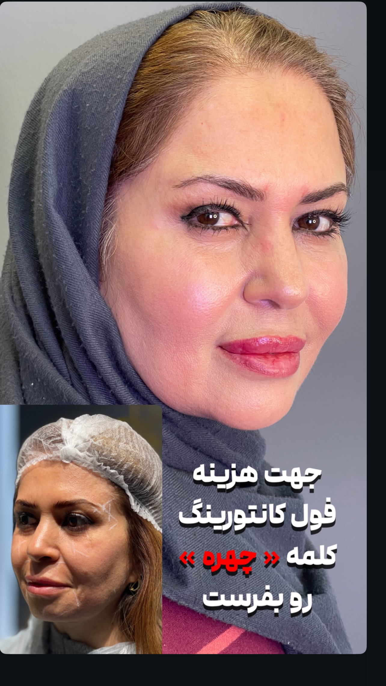 کلینیک زیبایی فیل بیوتی - تصویر 52