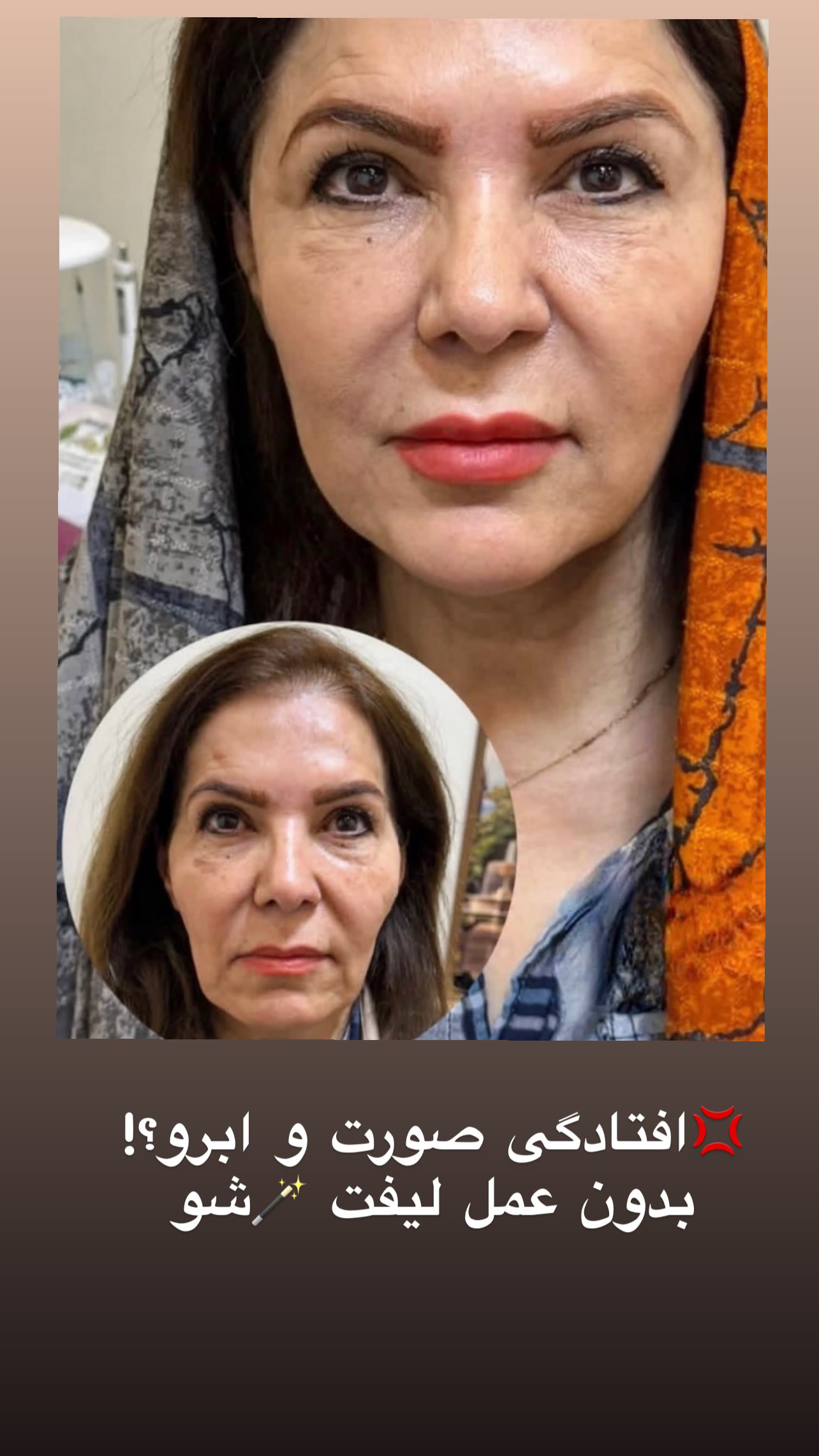 کلینیک زیبایی فیل بیوتی - تصویر 47