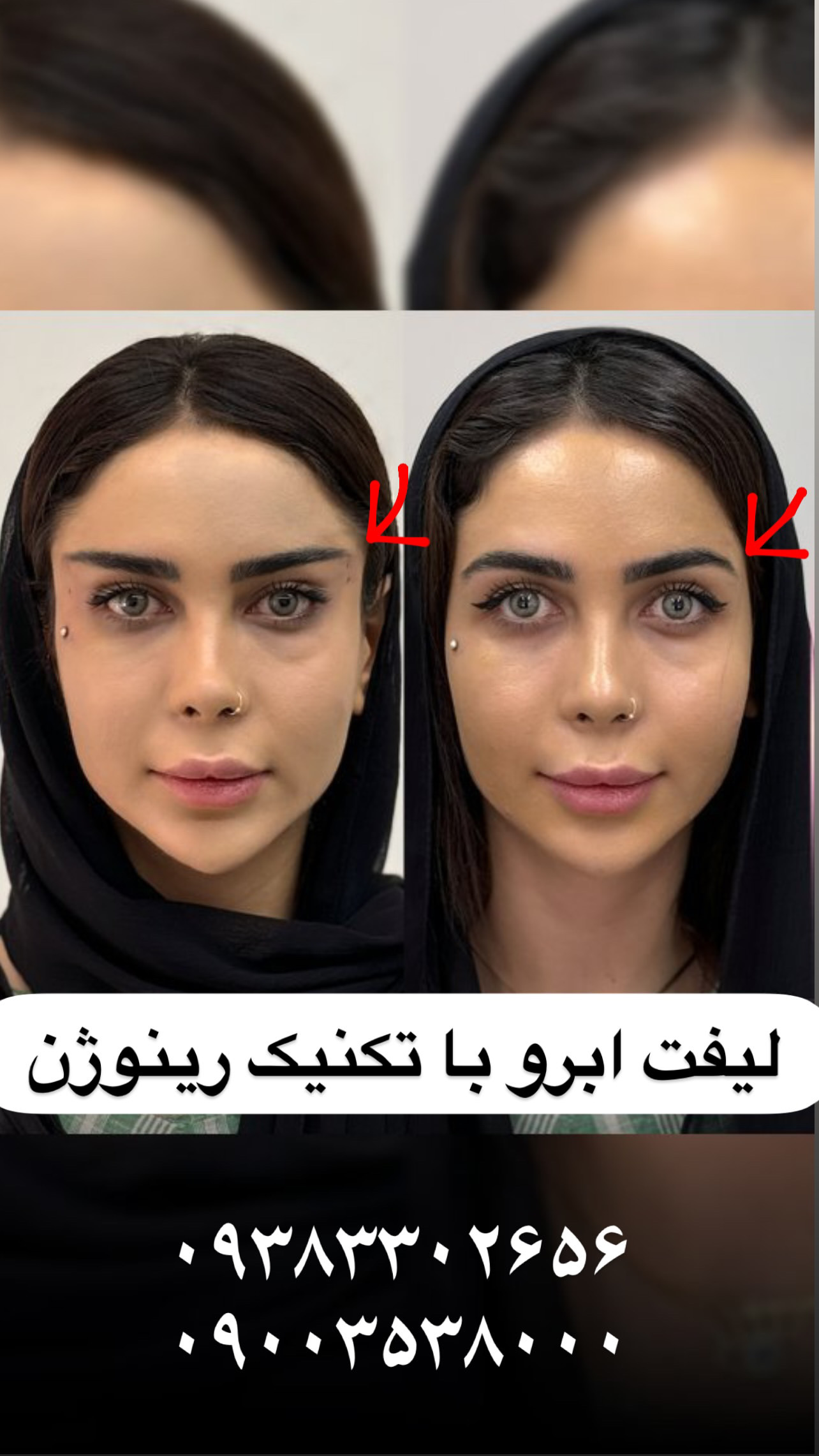 کلینیک زیبایی فیل بیوتی - تصویر 50