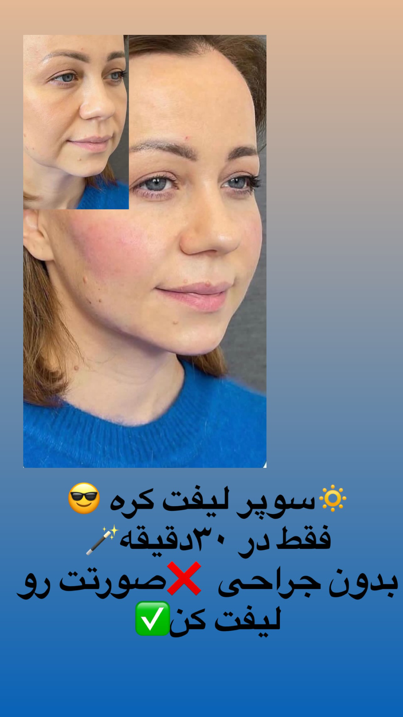 کلینیک زیبایی فیل بیوتی - تصویر 48